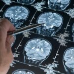 Study reveals diet and lifestyle play key roles in age-related brain disorders