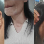 Delhi assault case rekindles safety concerns for Northeast residents